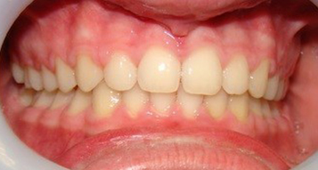 After After