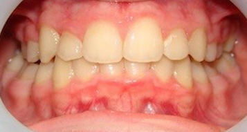 After After