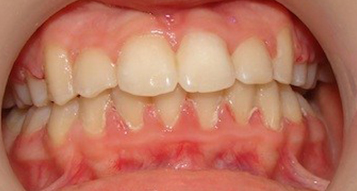 After After