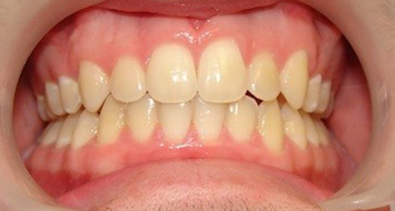 After After