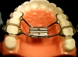 Jaw Expander, How to Turn